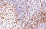 Anti-CD2 CE/IVD per IHC - Ematopatologia