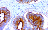 Anti-CEA CE/IVD per IHC - Patologia ginecologica
