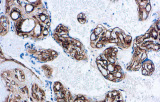 Collagene IV