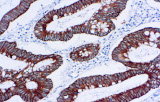 Citocheratina 18