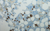 Reagenti per l'immunoistochimica