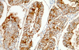 CE/IVD anti-EpCAM per IHC - Patologia gastrointestinale