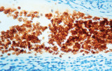 Glicoraina A