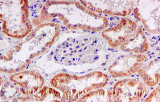 Prodotti per l'immunoistochimica (IHC)