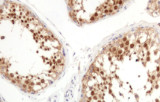Anti-Inibina alfa CE/IVD per IHC - Patologia genitourinaria