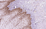 Anti-MLH1 CE/IVD per IHC - Patologia gastrointestinale