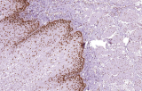 Test anti-MSH6 CE/IVD per immunoistochimica - Patologia gastrointestinale