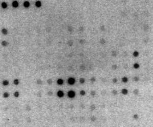 Qualitative Cytokine antibody microarray