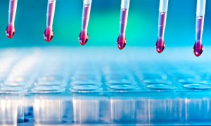 Kit per analisi delle proteasi