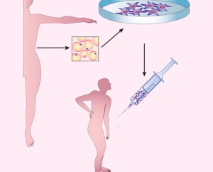 Medisch en therapeutisch gebruik van stamcellen