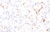 Anti-BSEP CE/IVD voor IHC – Gastro-intestinale pathologie