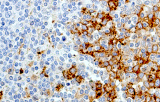 Anti-CD138 CE/IVD voor IHC - Hematopathologie
