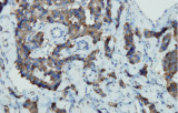 Anti-chromogranine A CE/IVD voor IHC – Gastro-intestinale pathologie