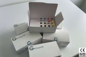 LymphoSign: CE/IVD-kit voor de classificatie van non-Hodgkin-lymfomen