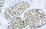 Anti-GATA3 CE/IVD voor IHC - Gynaecologische pathologie