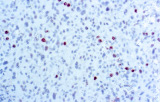 Anti-fosfohistone H3 (PHH3) CE/IVD voor IHC - Gynaecologische pathologie