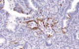 Anti-MUC5AC CE/IVD voor IHC – Gastro-intestinale pathologie