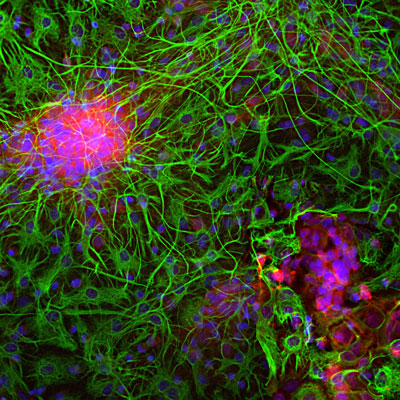 Immunolabeling of E20 rat mixed neuron and glial cultured cells labeled with anti-neuron specific enolase antibody (Cat. 1520-NSE, red, 1:500) and anti-GFAP antibody (Cat. 621-GFAP, green, 1:5000). The blue is Hoechst stain of nuclear DNA. Anti-NSE labels protein expressed in neuronal cells and anti-GFAP labels protein expressed in intermediate filaments in astrocytic and other glial cells.