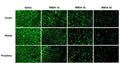 Immunofluorescence staining of flat-mounted mice retinas with RBPMS (green) at different times after NMDA injury. RGCs were quantified in three areas (center, middle, periphery) in each of the four quadrants of the retina depending on relative location to optic nerve head. Image from publication CC-BY-4.0. PMID: 36289519