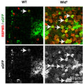 RBPMS staining (Cat. 1832-RBPMS, 1:500; red) and eGFP staining (green in upper panels and grey in lower panels) in post-mortem retinal explants of C57BL/6J and B6.BOla-WldS mice that were transduced with AAV2-SYN-eGFP ex vivo. Mouse explants were stained for eGFP. Image from publication CC-BY-4.0. PMID: 36635457