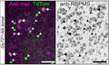Confocal micrograph of melanopsin, TdTomato, and RBPMS (Cat. 1832-RBPMS) co-staining in the dorsal GlyT2Cre;Ai9 mouse retina. The left arrows indicate RBPMS-positive GlyT2Cre ipRGCs. All melanopsin-negative, TdTomato-positive cells are RBPMS negative (arrowheads). Image from publication CC-BY-4.0. PMID: 36932080