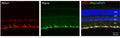 Immunostaining of mouse retina showing labeling of Rbfox1 (red), RBPMS (green), and DAPI(blue). Image from publication CC-BY-4.0. PMID: 35730583