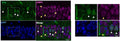 Representative images of CA1 region of mouse hippocampus. White arrows indicate cFos+ cells (Cat. 309-cFOS), yellow arrows indicate 53BP1 + cells. Nuclei stained with DAPI (blue). Right: zoomed images of the white boxes. Image from publication CC-BY-4.0. PMID: 36732588