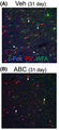 (A, B) confocal microscope images showing PV, WFA, and c-Fos (Cat. 309-cFOS) staining after vehicle or ABC treatment in the prelimbic PFC after vehicle or ABC 31 days later. White arrows indicate triple-labelled cells. Note faint staining of PNNs after ABC treatment. Image from publication CC-BY-4.0. PMID: 37855072.