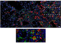 Immunolabeling of Pro-Col1a1 (Cat. 321, COLP, green), a Ct2-cluster marker, showing colocalization with tdTom+ cells from mouse lungs. Image from publication. CC-BY-4.0 PMID: 39945330.
