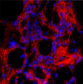 Immunostaining of formaldehyde-fixed fibrotic mouse lung tissue. The antibody recognizes mature collagen I (Cat. 322-COLT, 1:100, red) that has formed fibrils in the extracellular matrix. The blue is staining nuclear DNA.