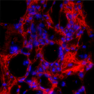 Immunostaining of formaldehyde-fixed fibrotic mouse lung tissue. The antibody recognizes mature collagen I (Cat. 322-COLT, 1:100, red) that has formed fibrils in the extracellular matrix. The blue is staining nuclear DNA.