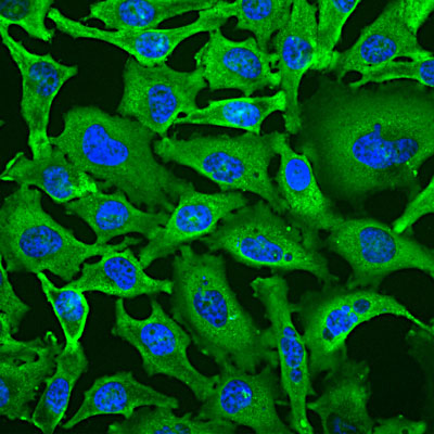 Immunostaining of HeLa cells labeled with Anti-GAPDH (Cat. 600-GAPDH, 1:100, green) and nuclear staining with DAPI (blue). The anti-GAPDH produces strong cytoplasmic labeling of healthy cells.