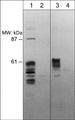 Western blot analysis of rat PC12 cells (lanes 1 & 2) and human PC-3 cells (lanes 3 & 4). The blots were probed with anti-Sema-3E (N-terminal region) antibody in absence (lanes 1 & 3) or presence of Sema-3E (N-terminal region) blocking peptide (lanes 2 & 4).