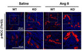 Immunolabeling of mouse kidney paraffin section specifically detecting NCC Thr53 (Cat. p1311-53, red, 1:1000) phosphorylation with the increased NCC activation in Ang-II-infused Prdx5 KO kidney. Image from publication, CC-BY-4.0. PMID: 39857434.