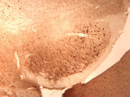 Immunolabeling of mouse substantia nigra (mid brain) labelling the α1-subunit of the GABAA Receptor (cat. 811-GA1C, DAB, 1:100). Images courtesy Dr. Anton Reiner, University of Tennessee Health Science Center (Memphis, TN).