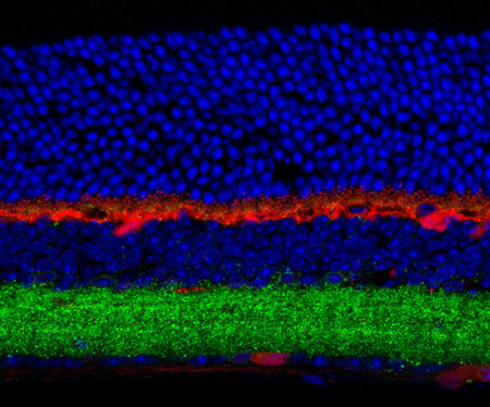 Immunofluorescence of mouse retina showing staining of GABAA-R, β3-subunit (cat. : 863A-GB3C, green, 1:300) and calbindin (red). The blue is DAPI staining nuclear DNA. Photo courtesy of Dr. Arlene Hirano, UCLA.