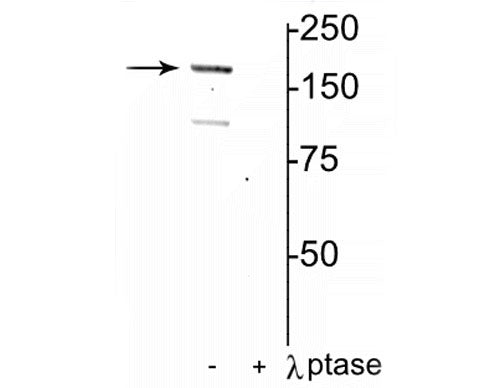 Western blot of rat hippocampal lysate showing specific immunolabeling of the ~180 kDa NR2A subunit of the NMDAR phosphorylated at Tyr1325 in the first lane (-). Phosphospecificity is shown in the second lane (+) where immunolabeling is completely eliminated by lysate treatment with lambda phosphatase (400 units/100uL lysate for 30 min).