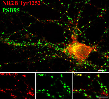 Immunostaining of 14 DIV rat cortical neurons showing NR2B phosphorylated at Tyr1252 (red, 1:400) and PSD95 (green). Photo courtesy of Gang Liu.