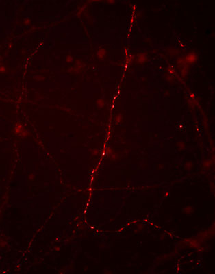 Immunostaining of cultured mouse caudate neurons showing synapsin I when phosphorylated at Ser9 (cat. p1560-9, 1:500, red). Cells and photo courtesy of QBMCellScience.