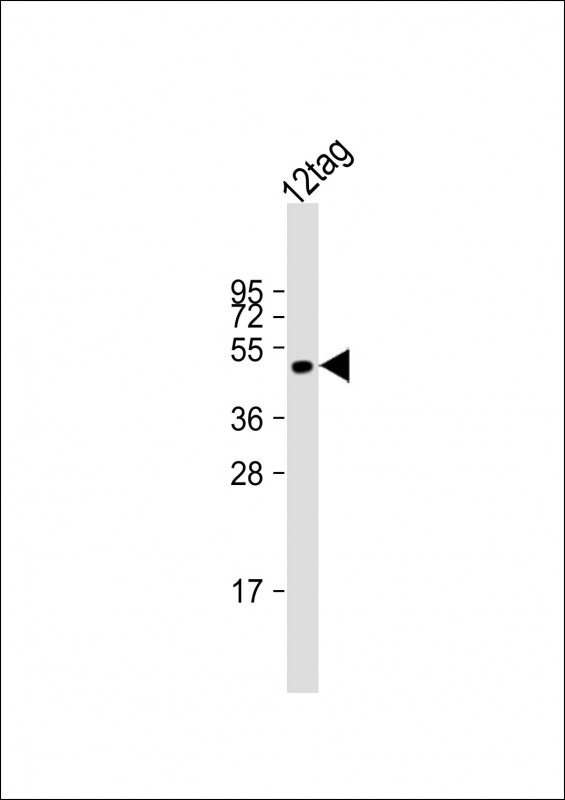 WB - FLAG Tag Antibody AM8495b