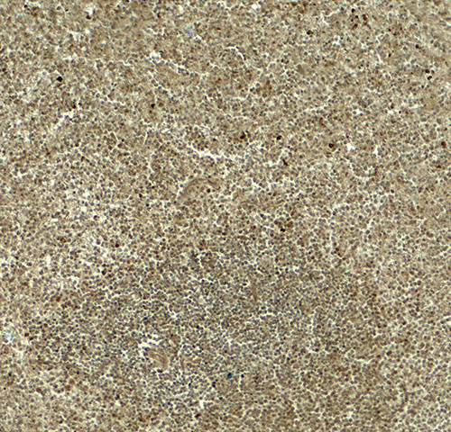 IHC - DTX4 Antibody ASC11879