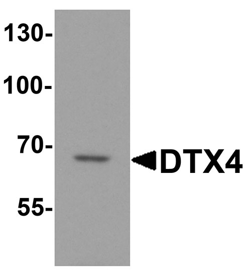 WB - DTX4 Antibody ASC11879