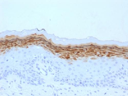 IHC-P - Anti-Filaggrin Antibody AH13218-20