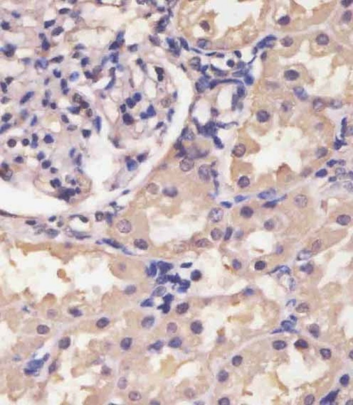 IHC-P - HIF1A Antibody AP4879d