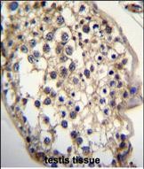 IHC-P - DHCR7 Antibody (C-term) AP11452b