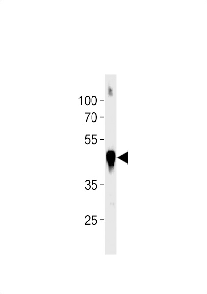 WB - Zebrafish actba Antibody (Center) Azb10021c