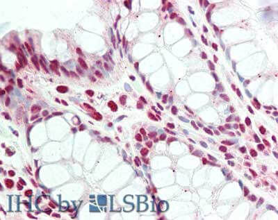 IHC - Anti-PRDM1/BLIMP1 (RABBIT) Antibody ASR5483