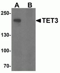 Anti-TET3 antibody used in Western Blot (WB). GTX02579
