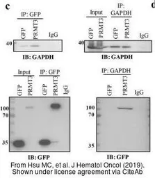 Anti-GAPDH antibody used in Western Blot and Immunoprecipitation (WB IP). GTX100118