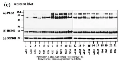 Anti-GAPDH antibody used in Western Blot (WB). GTX100118